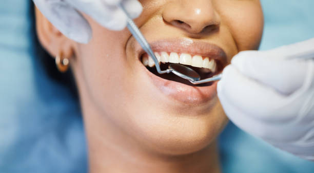 Best Emergency Dental Care for Abscessed Tooth in West Linn, OR